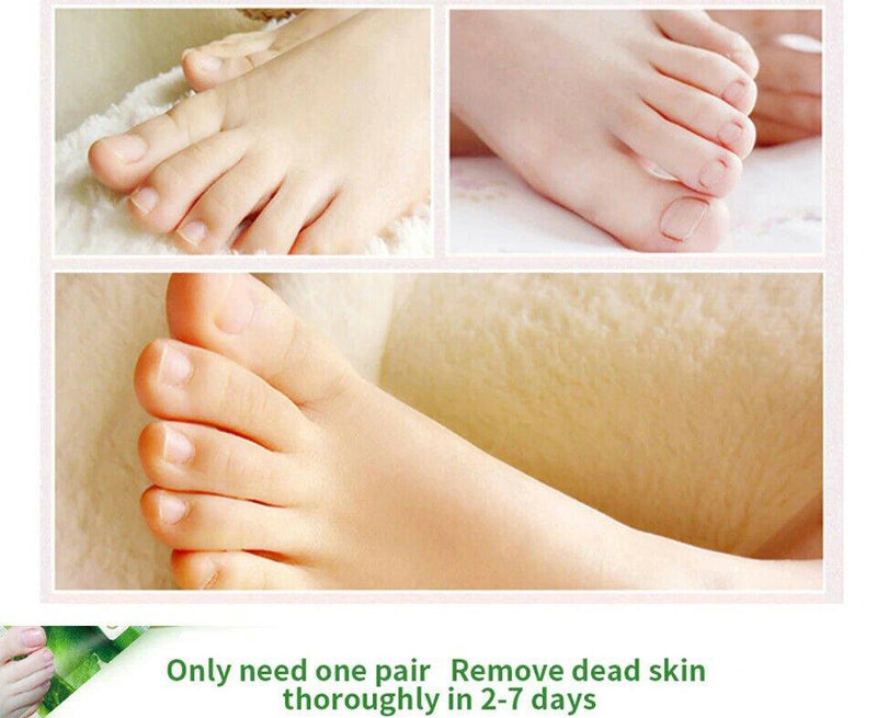Milk Essence Foot Mask Skin Care - WELLQHOME
